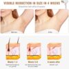 Beauty Professional Hair Removal IPL 3 en 1