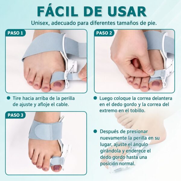 Corrector Ajustable de Juanetes Unisex con Perilla de Rosca para Hallux Valgus